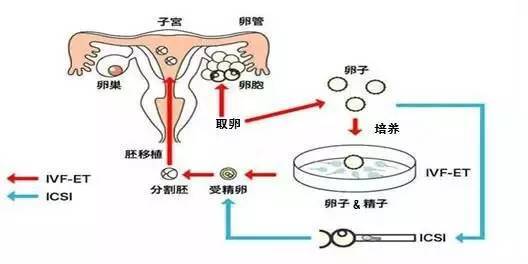 温州三代试管